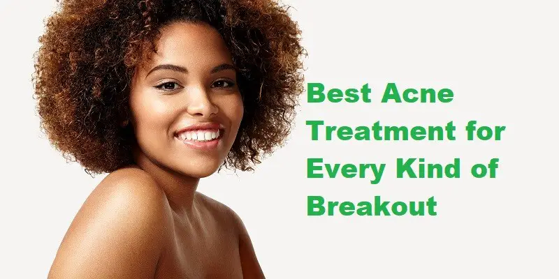 El mejor tratamiento para el acné para cualquier tipo de brote.