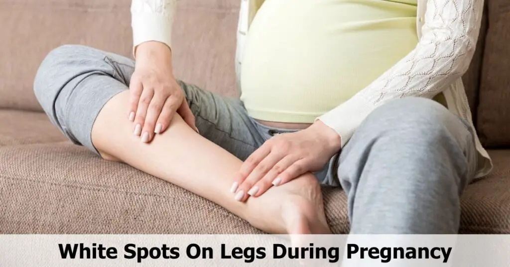 Manchas blancas en las piernas durante el embarazo.